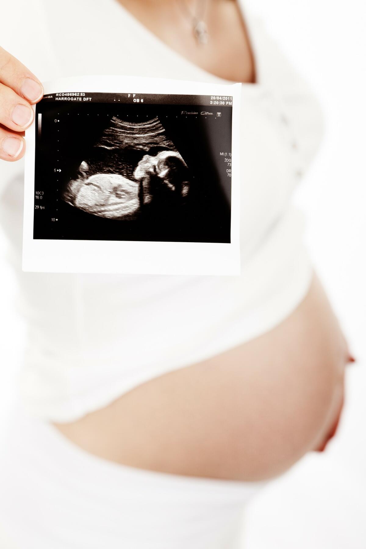 I test di screening prenatale da effettuare durante la gravidanza (esame ecografico) - 