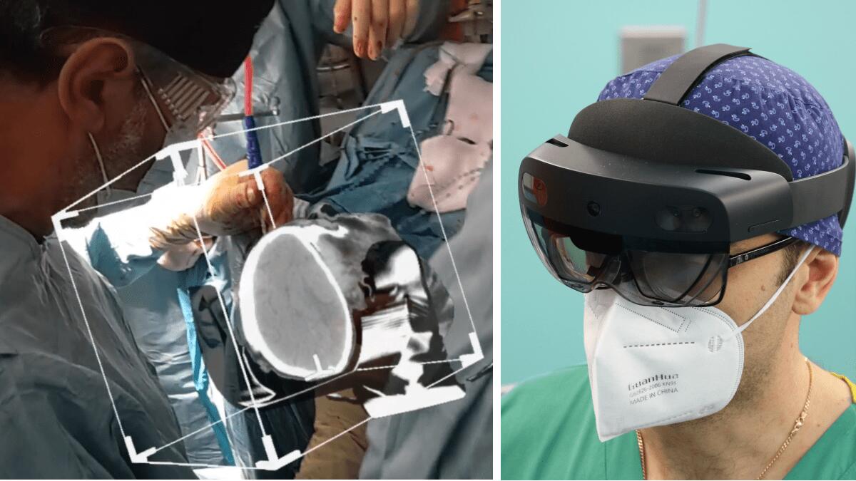Cominciano i test della realtà aumentata: ologrammi in Neurochirurgia all’Ospedale Cannizzaro - 