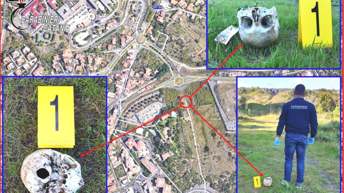 Rinvenuto teschio umano nella zona dell'ospedale Cannizzaro di Catania: si cerca di risalire all'identità - 