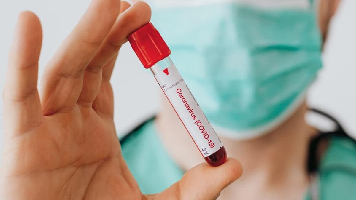 "Screening sull'immunità con test sierologici", la proposta della Ugl Salute Sicilia (I DETTAGLI) - 