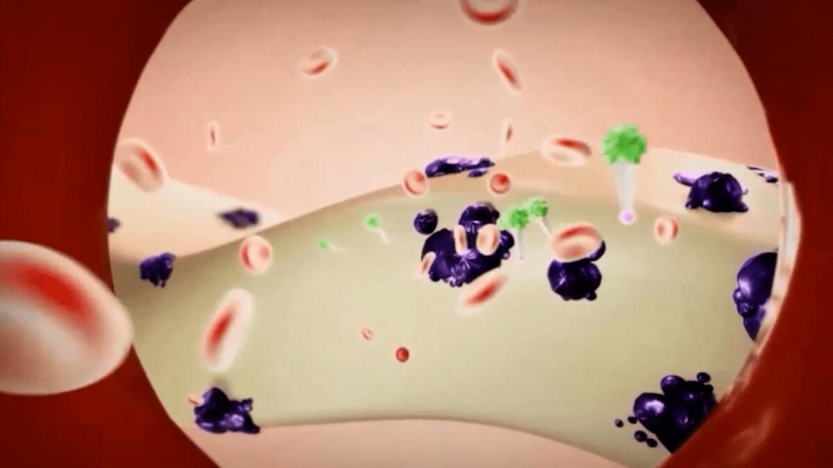 Tumore della prostata: nuovo radiofarmaco “Fluoro-PSMA” utilizzato all’ospedale Cannizzaro (VIDEO E DETTAGLI) - 