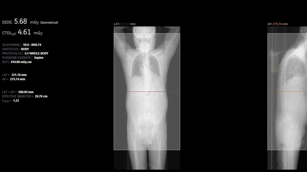 Nuovo sistema per preservare la salute di chi effettua esami radiologici all’ospedale Cannizzaro - 