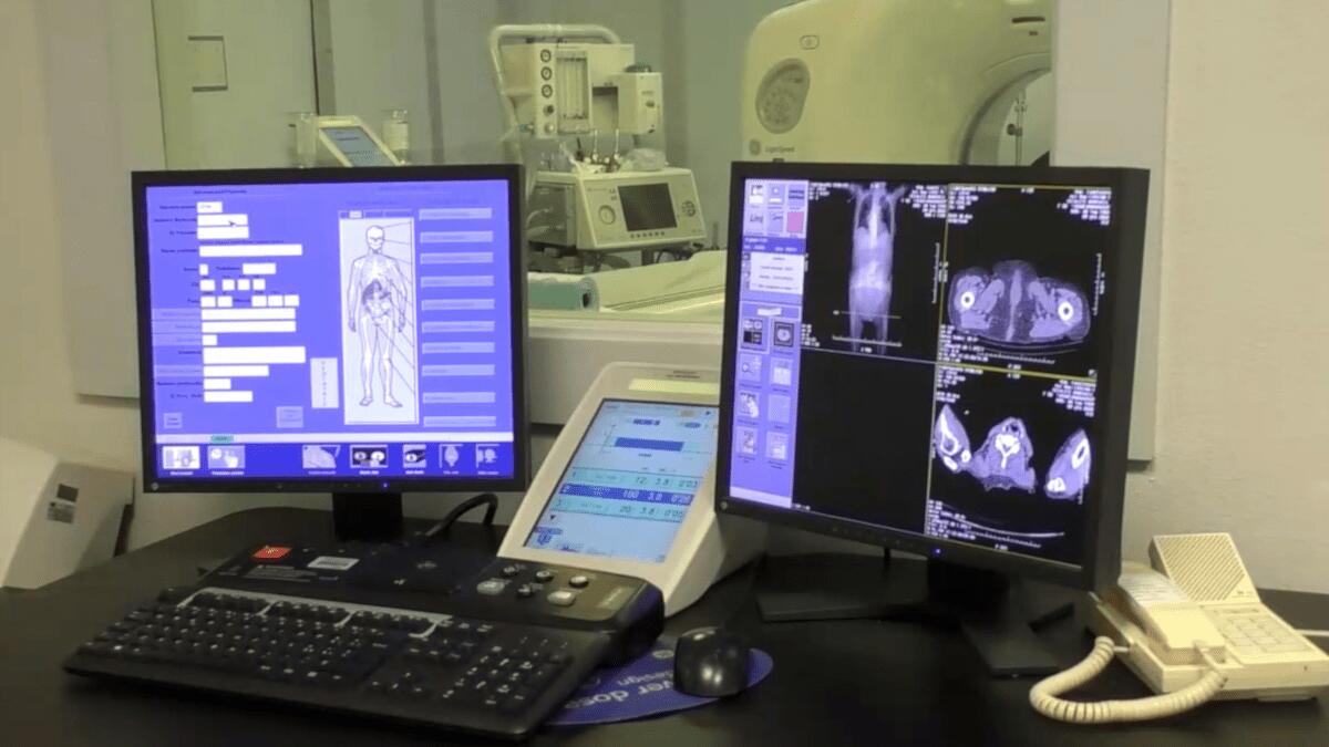 Tumore al polmone: screening gratuito all’Ospedale Cannizzaro (COME ADERIRE) - 