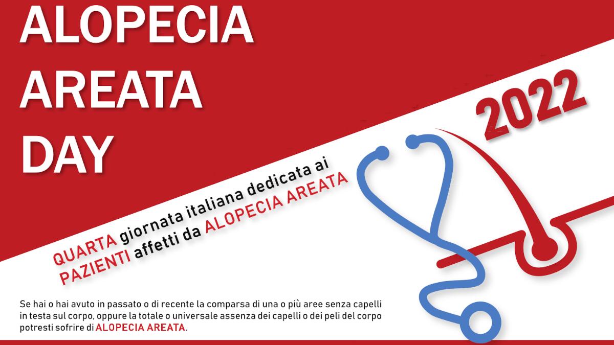 Alopecia Areata Day: visite dermatologiche gratuite negli ambulatori catanesi (DOVE E QUANDO) - 