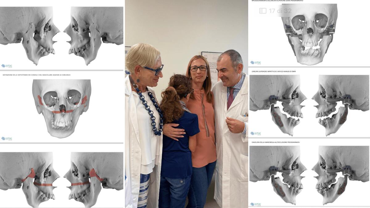 All’ospedale San Marco l’intervento chirurgico permette ad Aurora di aprire la bocca dopo 16 anni - 