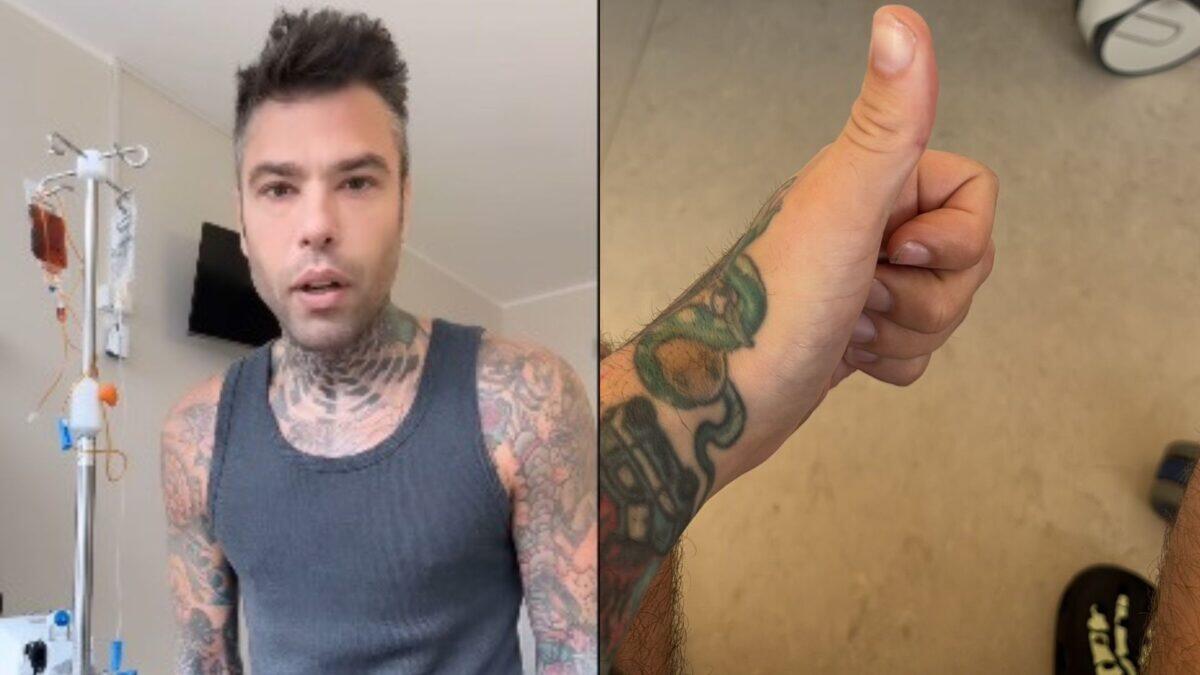 Fedez dall'ospedale svela la verità dietro il ricovero: scordatevi la fantascienza - 