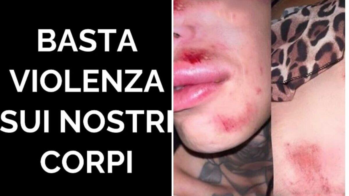 Un gruppo attacca due donne trans durante una festa di paese nel viterbese! - 