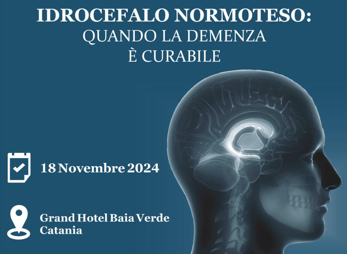 Idrocefalo normoteso: la verità che i medici non vogliono dirti | Scopri perché questa malattia potrebbe essere la chiave per curare la demenza! - 