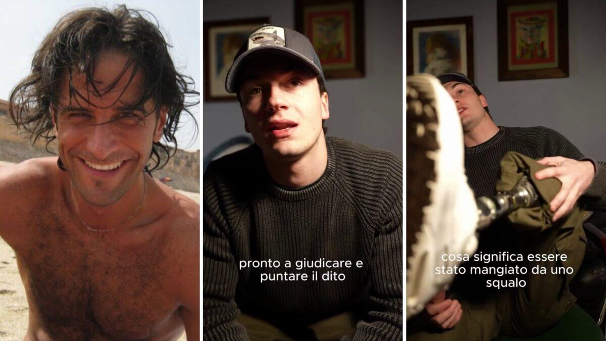 Squalo vs Umanità: la sorprendente risposta di un giovane che ha perso una gamba contro l’odio della rete