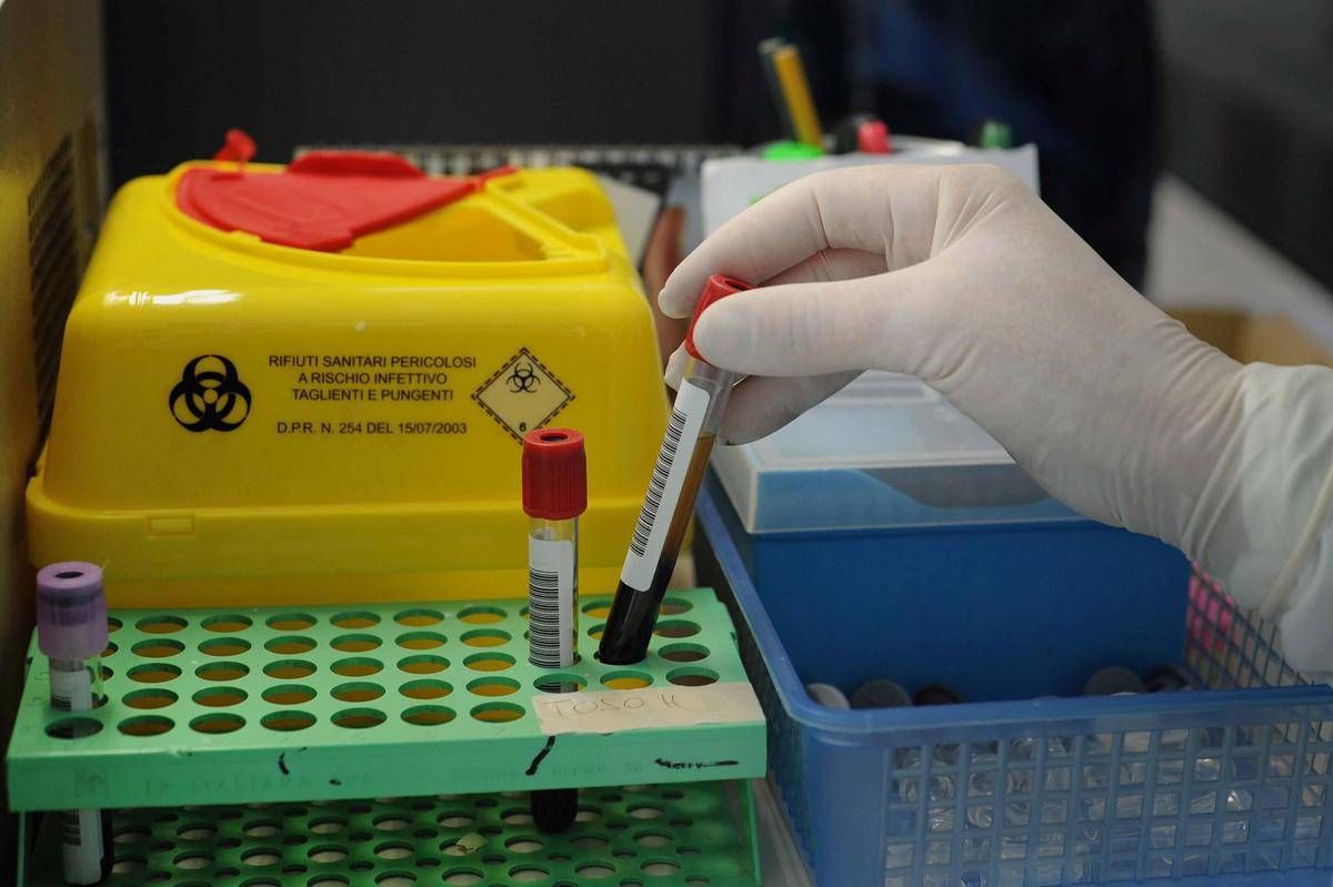 Alzheimer, via libera a test del sangue per diagnosi: cosa significa - 