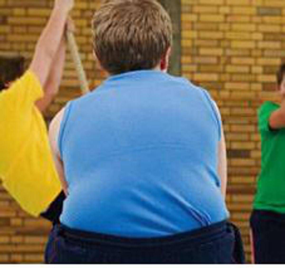 Obesità grave pediatri Sip: "Per oltre 100mila bimbi rischio -15 anni vita" - 