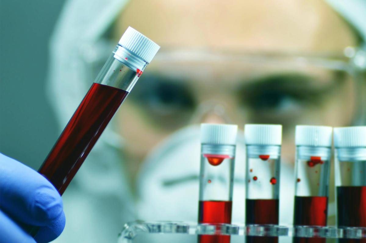 Alzheimer, Sin: "Test del sangue svolta epocale per diagnosi tempestive e cure mirate" - 