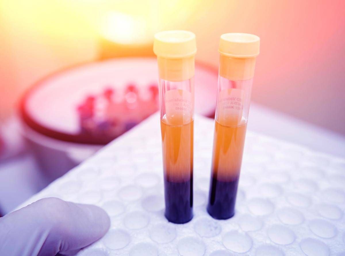 Farmaci, Sava (Sif Magazine): "In plasmaderivati attenzione particolare a sicurezza" - 