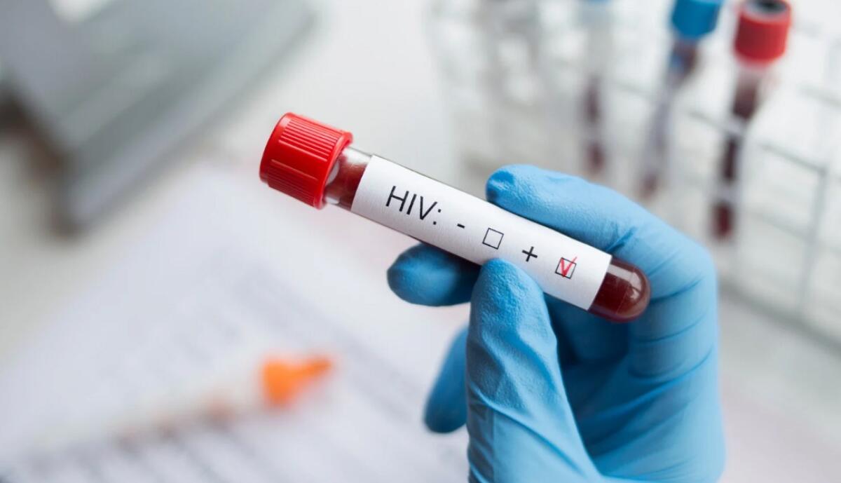 mRNA potrebbe sconfiggere l’HIV | Ma perché è ancora sotto attacco? -