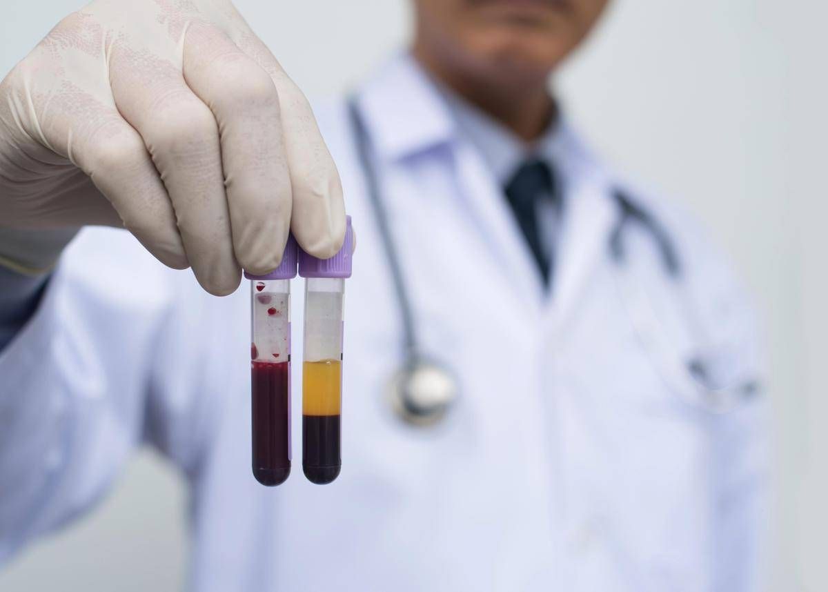 Farmaceutica, Gardini (GenomeUp): "Ai per programmare terapie con plasmaderivati" - 