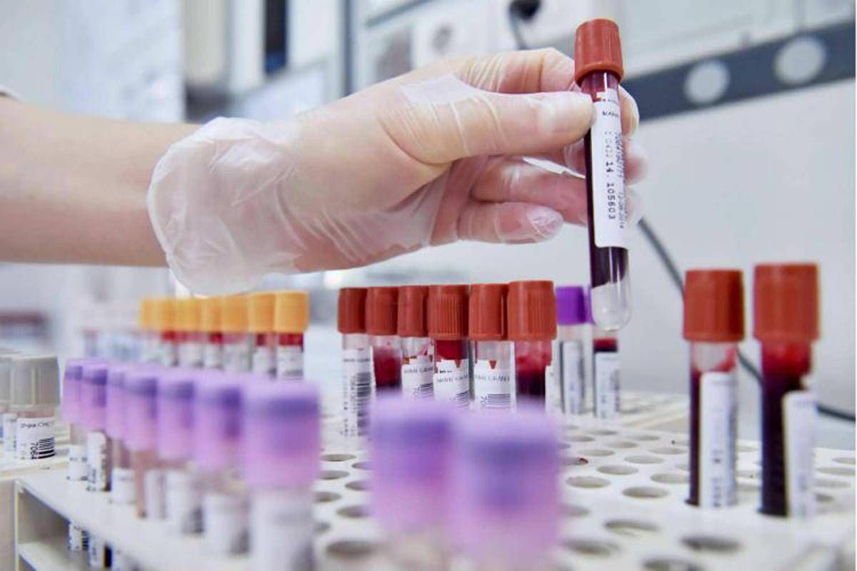 Tumore alla prostata, novità nelle terapie dei casi più gravi - 