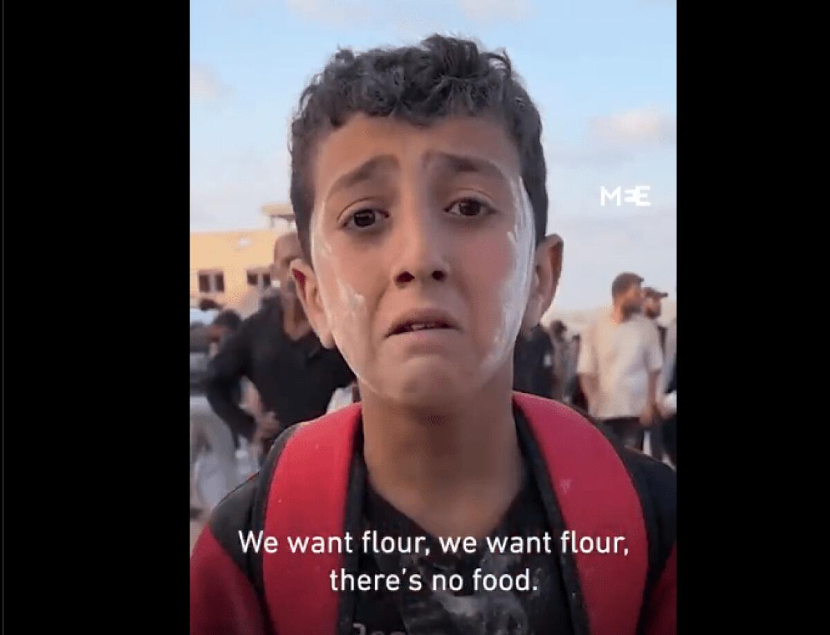 Bambino di Gaza mangia sabbia: appello disperato che fa tremare il mondo | Cosa stiamo facendo per fermare questa crisi? - 