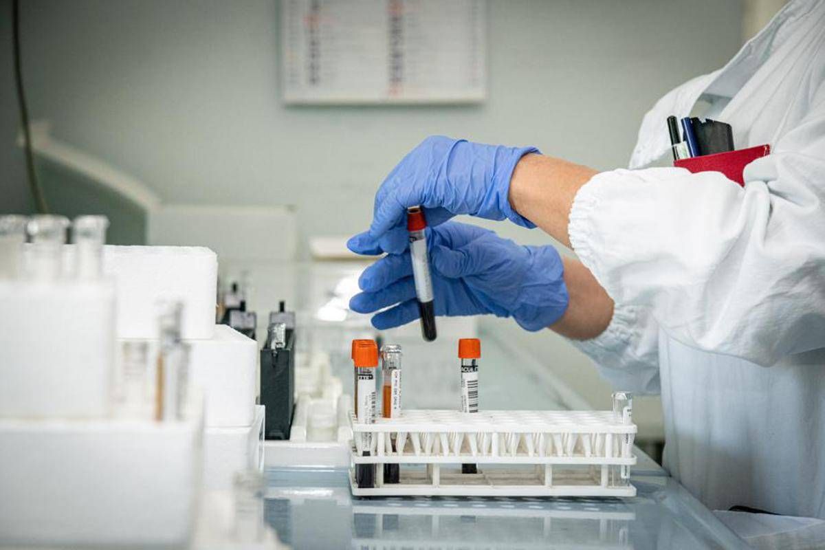 Mielofibrosi, ematologo: "Con uso precoce momelotinib maggiore sopravvivenza" - 