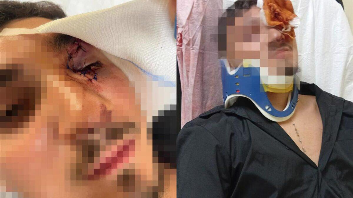 Aggressione a Portici: il saluto di un ragazzo diventa un incubo | La violenza tra i giovani è fuori controllo? -