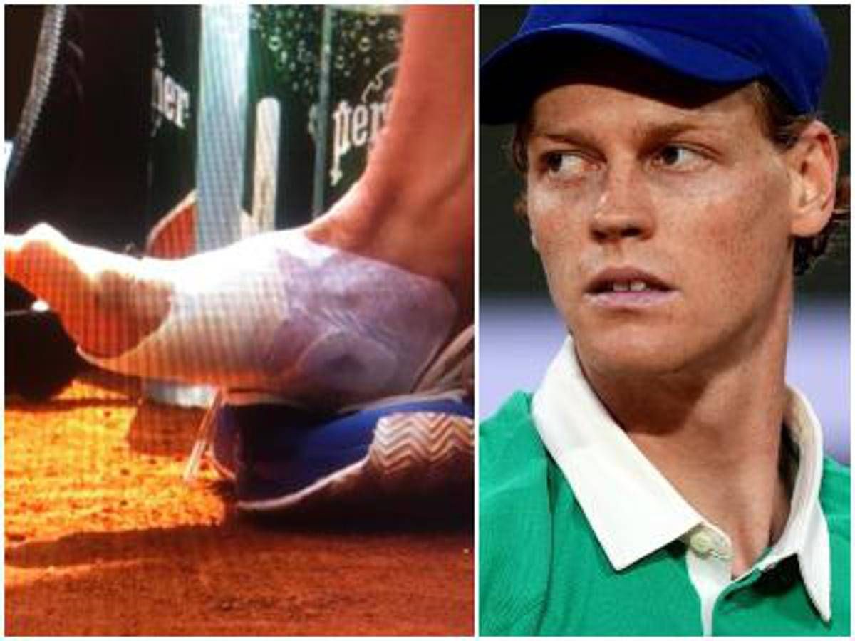 Sinner, problema vesciche al Roland Garros. Il precedente a Roma -