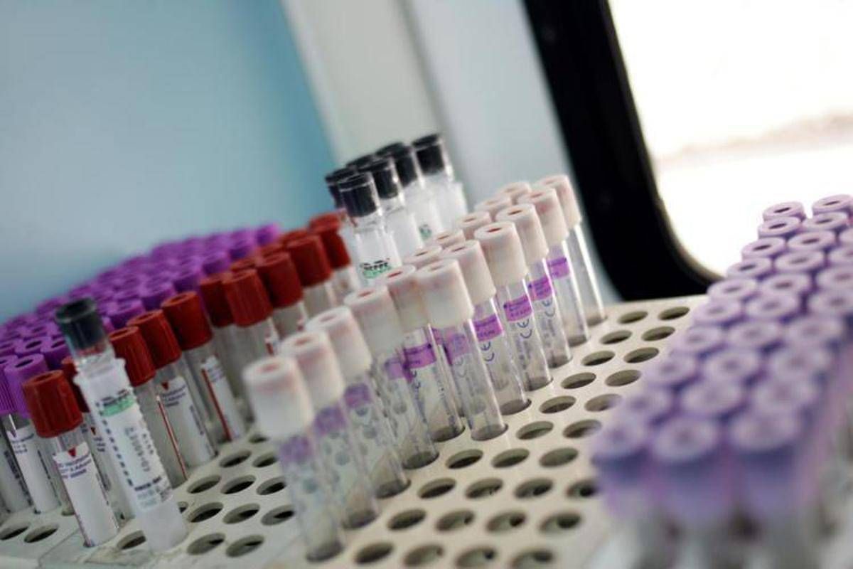 Mielofibrosi, speranze da nuovo farmaco che limita l'anemia in 2 pazienti su 3 - 