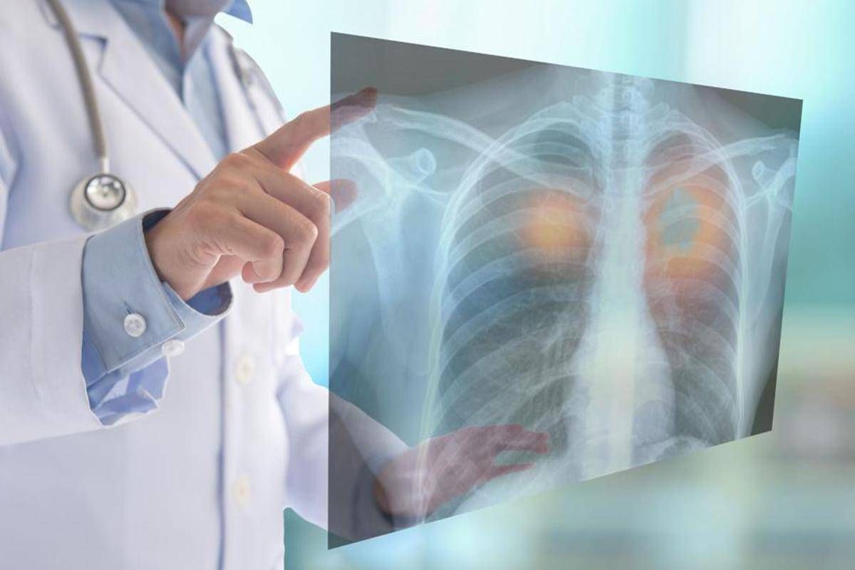 Fine vita, oncologi: "No a Comitato nazionale e a esclusione Ssn, subito confronto" -