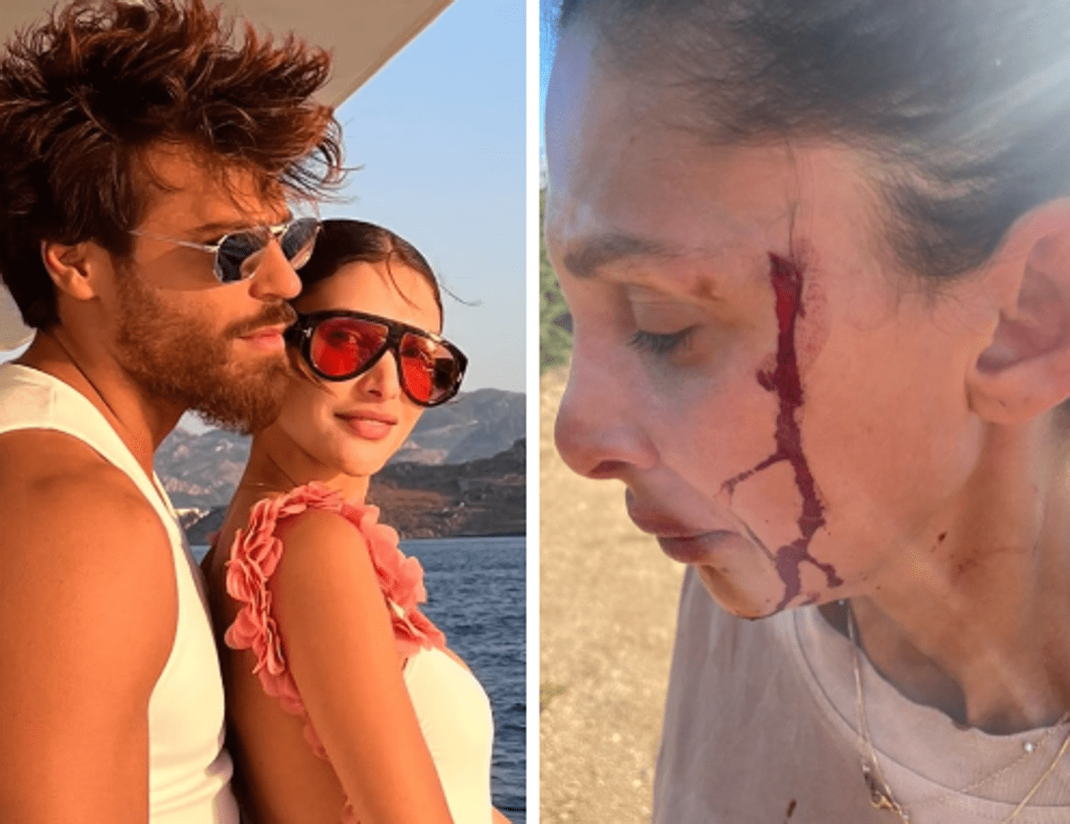 Can Yaman, la fidanzata Sara Bluma denuncia le violenze dell'ex. L'attore: "Ti amo" - 
