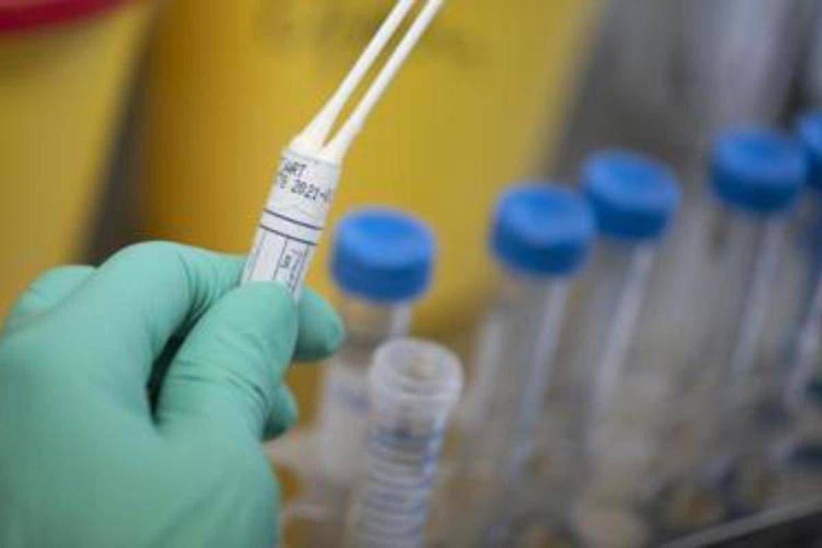 Legionella in case popolari a Milano, un morto e diversi ricoverati - 