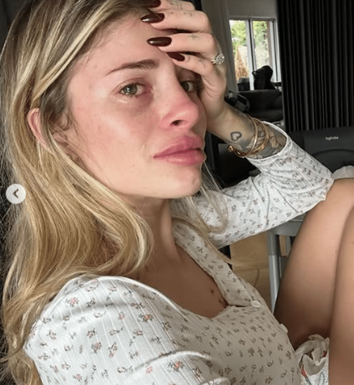 Chiara Nasti, lo sfogo: "Depressione, attacchi di panico, ho preso psicofarmaci" -