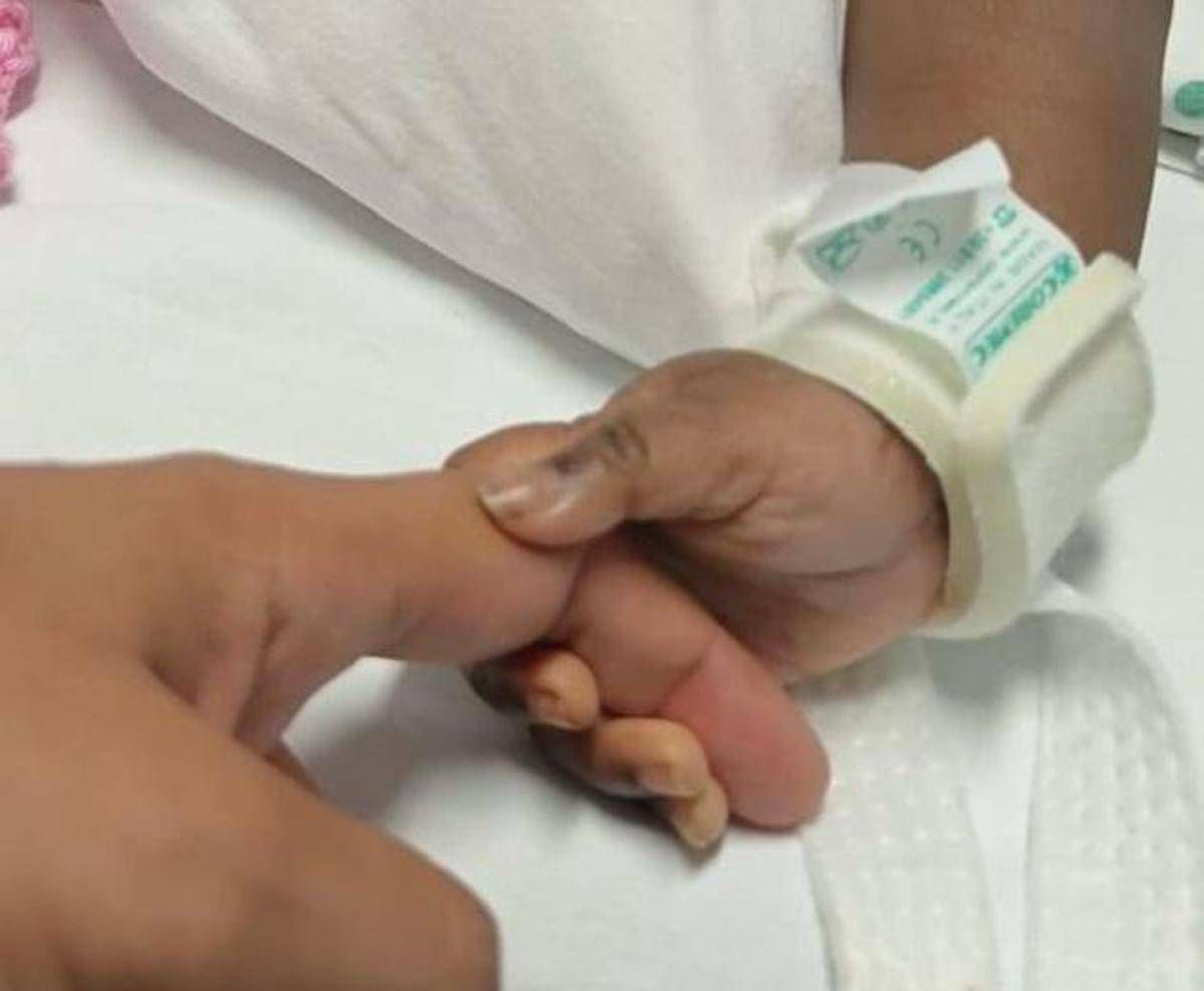 Gemelle siamesi separate al Gaslini di Genova: "Estubate, respirano da sole" - 