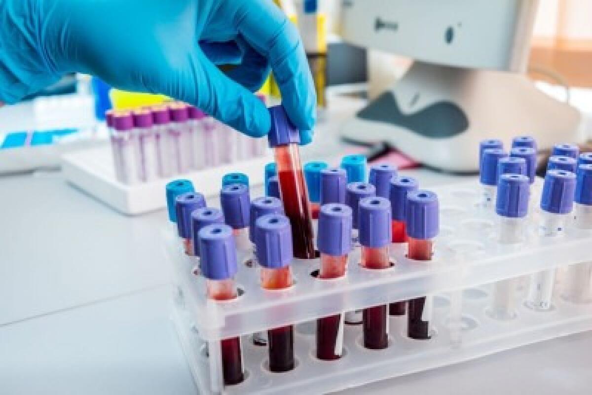 Sala prelievi chiusa per un giorno | Scopri perché gli esami di sangue si fermano in ospedale! - 