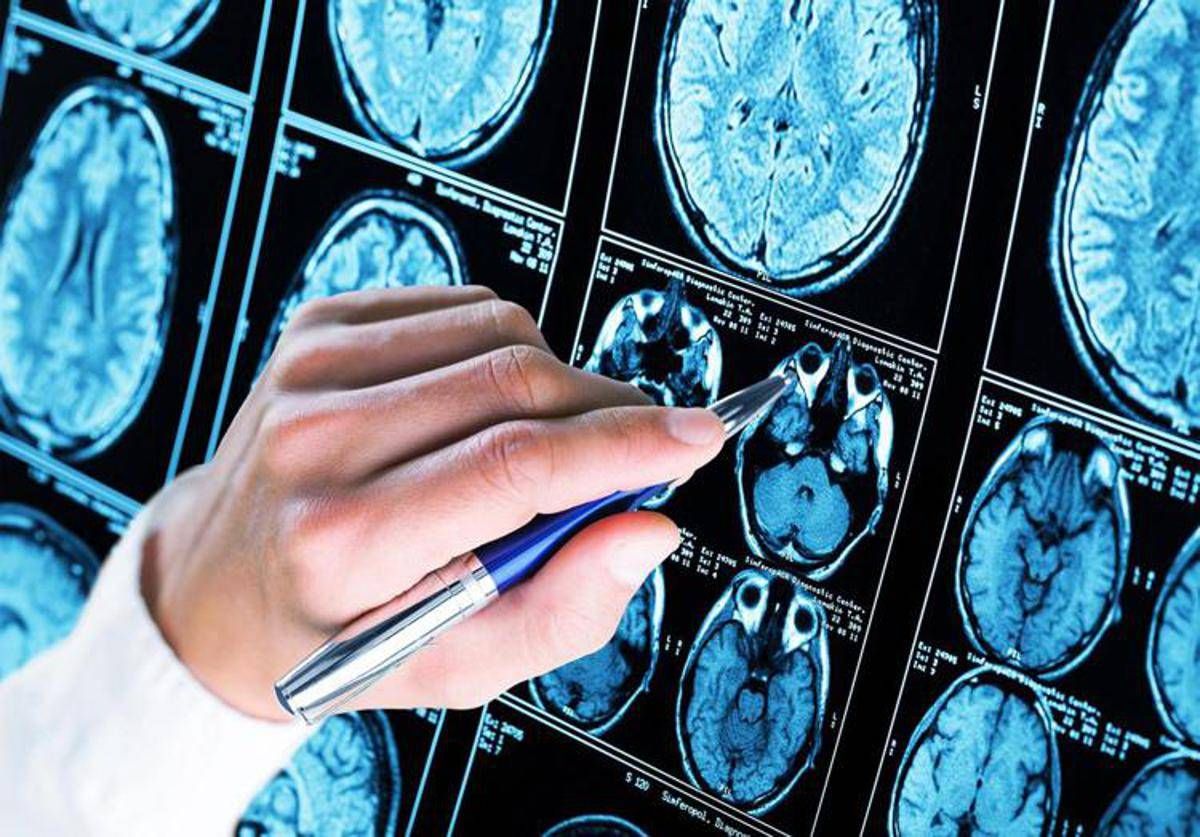 Farmaci, ok Ema a donanemab, neurologi: "Svolta in lotta all'Alzheimer" - 