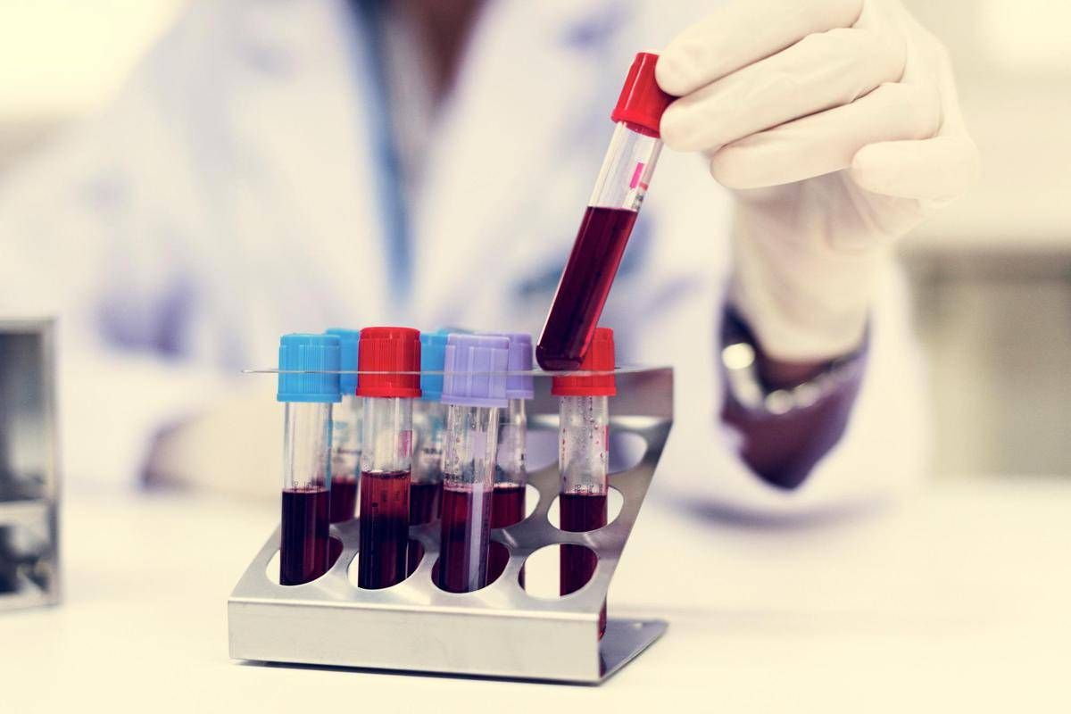 Nuovo tipo di diabete giovanile scoperto in Africa, la conferma che cambia la storia in un maxi studio -