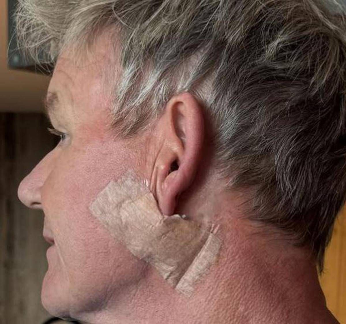 Gordon Ramsay: "Operato per tumore della pelle" - 
