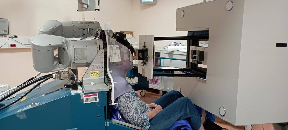Melanoma oculare, al Cnao trattati più di 600 pazienti con protonterapia -
