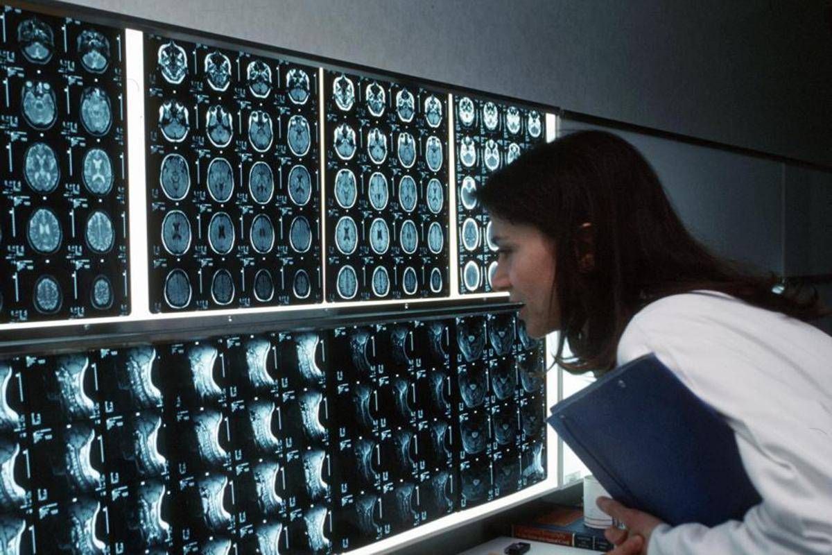 Radiologi Sirm: "Attenzione a medicina difensiva ed esami inappropriati" - 