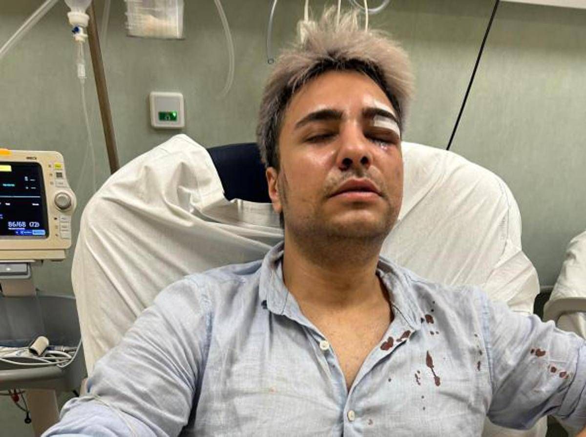 Roma, ancora un'aggressione omofoba: 25enne pestato dal branco - 