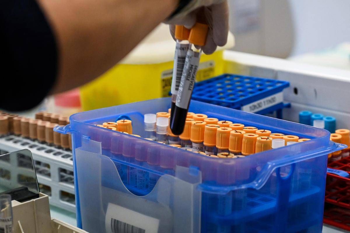 Fegato, un test per scoprire il rischio di gravi malattie entro 10 anni: lo studio - 