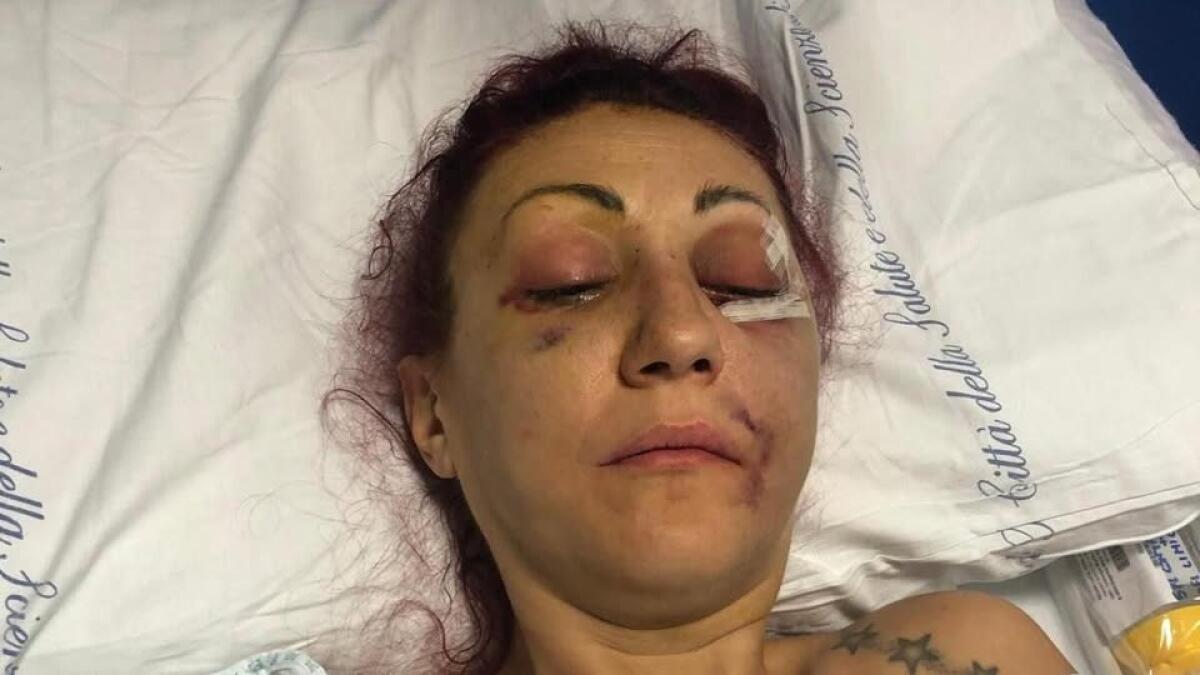 Torino: un uomo condannato per violenza, ma i giudici dicono “va capito”! | È davvero accettabile questa giustizia? - 