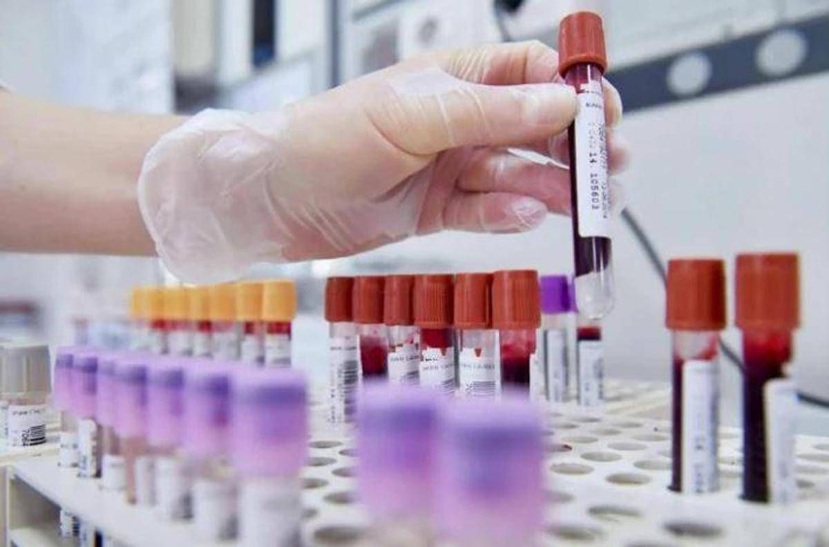 Tumori, cancro vescica: 70% pazienti libero da malattia a 2 anni con terapie perioperatorie -