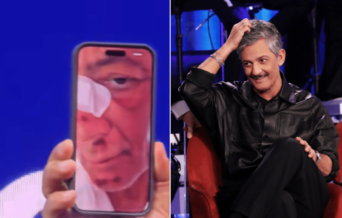 Fiorello, l'incidente in bicicletta: "Volevo fare il figo... sono caduto di faccia" - 