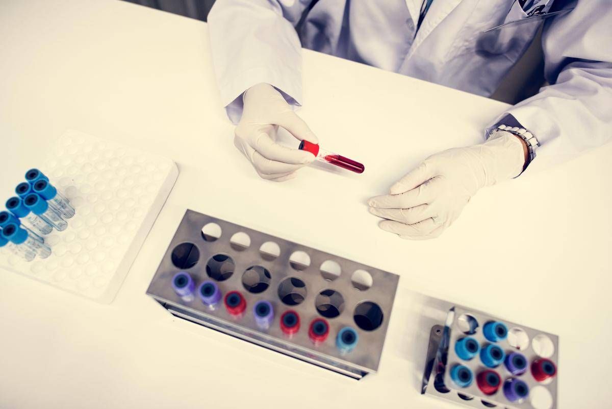 Cancro alla vescica, recidiva ridotta del 32% con immunoterapia durvalumab: lo studio -