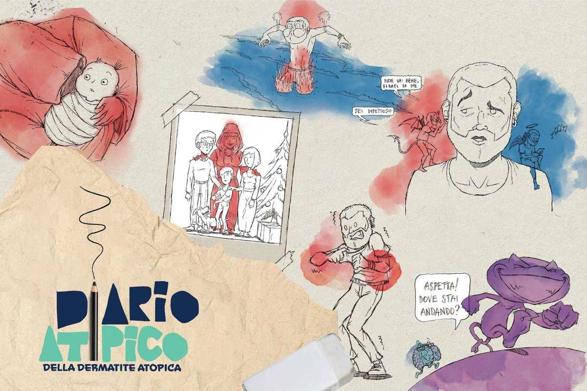 Dermatite atopica, oltre 1,3 mln di persone hanno visto il corto 'Diario atipico' -
