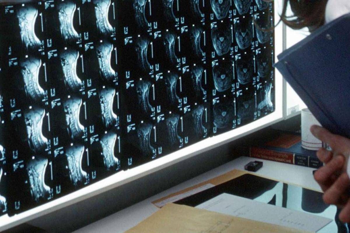 Oltre 500 malattie rare delle ossa, esperti: "Investire in prevenzione e diagnosi" - 