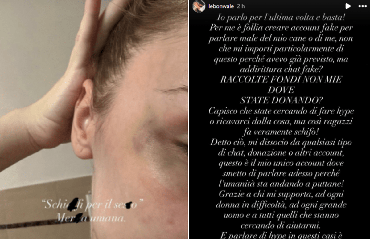 Rapper Faneto sotto accusa, l'ex fidanzata pubblica foto e messaggi di violenza -