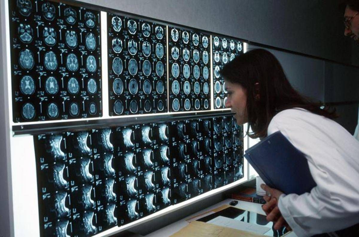 Cancro, 4 sintomi 'insoliti' che bisogna conoscere: parola di oncologo - 