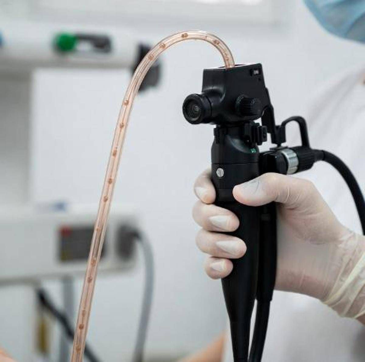 Esofagite eosinofila scambiata per depressione, cos'è e come riconoscerla - 