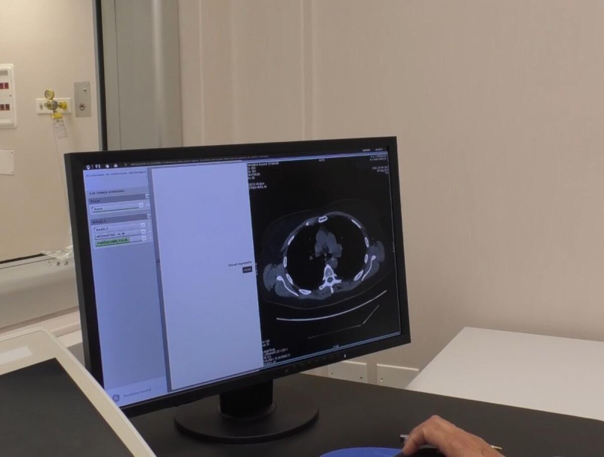 Ospedale Cannizzaro di Catania: scopri i segreti sorprendenti dello screening polmonare che sta salvando vite! - 