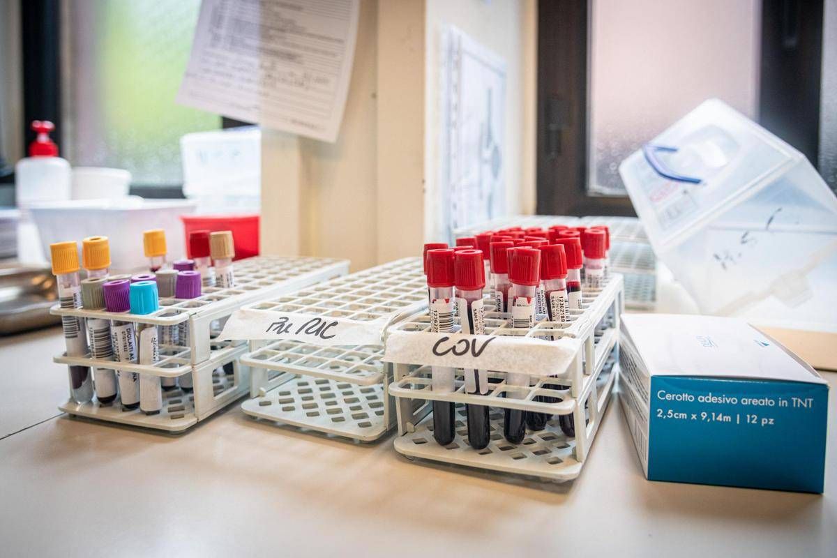 Medicina di laboratorio, 'un semplice esame per scoprire in anticipo le patologie' - 