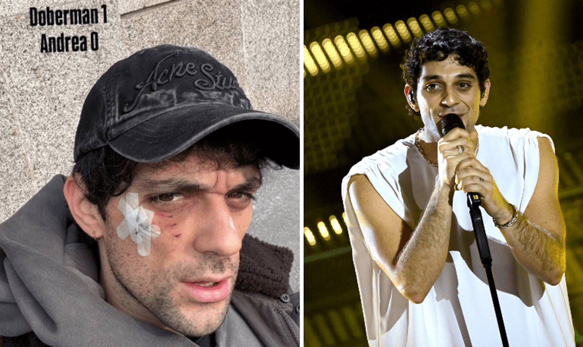 Bresh ferito al volto da un Dobermann, come sta il cantante - 